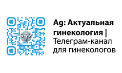 Тг-канал AG